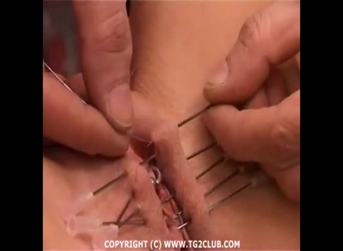 Video :Slut getting her pussy stitched and pinned